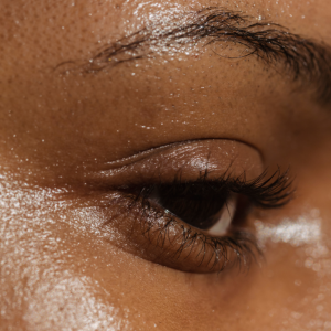 LASER SKIN REJUVENATION