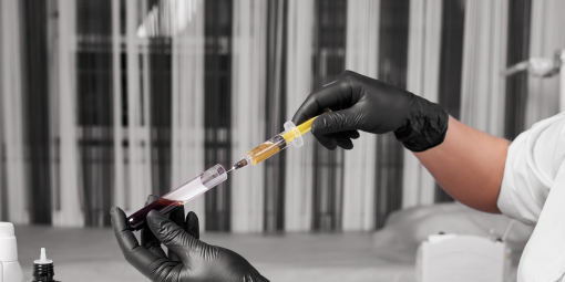 PRP Hair Restoration 6 Sessions