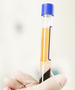 3x PRF Injections