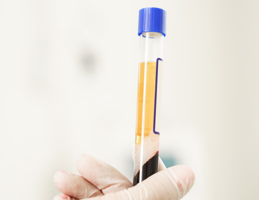 10x PRF Injections